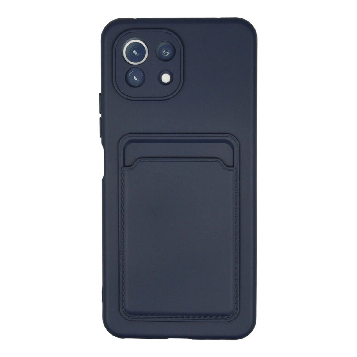 Xiaomi Mi 11 Kılıf Kelvin Kartvizitli Silikon - Lacivert
